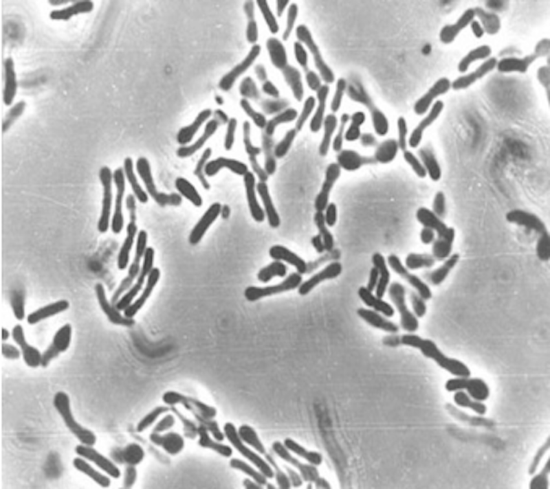 Bifidobacterium both produces and consumes mucin, a glycoprotein that protects the gut lining. Paola Mattarelli and Monica Modesto/Katz Lab via Flickr, CC BY-NC